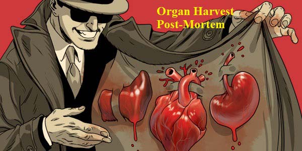 Harvest Organs: Post-Mortem